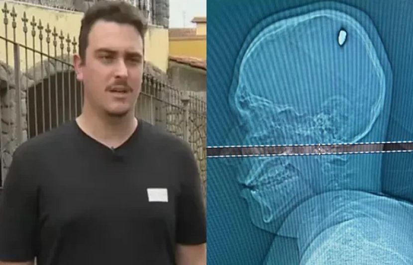 سر پر گولی لگی یا پتھر؟ 4 دن بعد حقیقت سامنے آگئی