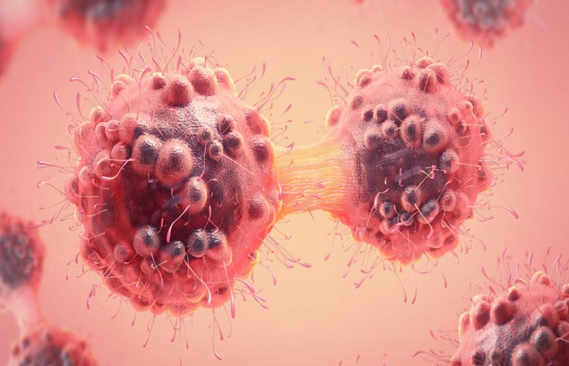 ڈیری غذاؤں کے استعمال میں کمی کینسر کی مہلک اقسام کے خطرات کو 25 فیصد تک کم کر سکتی ہے۔