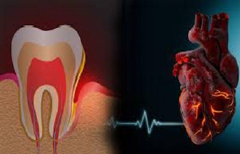 منہ کے جراثیم دل کے دورے کے خطرے کو بڑھا سکتے ہیں؟