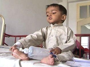 پنجاب بھر میں خسرے کی وبا کو قابو میں نہیں کیا جاسکا