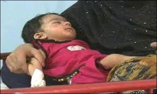 لاہور خسرہ سے متاثر زیر علاج بچے