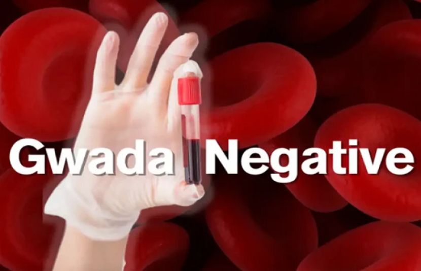 نیا بلڈ گروپ ’گوادا نیگیٹو‘ دریافت کر لیا