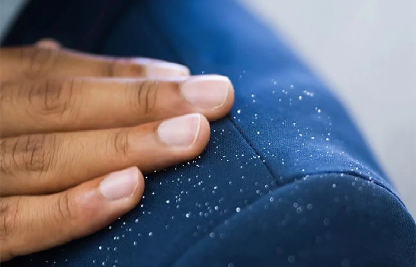 ڈینڈرف کا مسئلہ صرف عورتوں میں ہی عام نہیں ہے بلکہ بہت سے مردوں کو بھی اس کا سامنا رہتا ہے