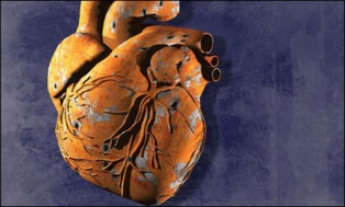 دل کے امراض