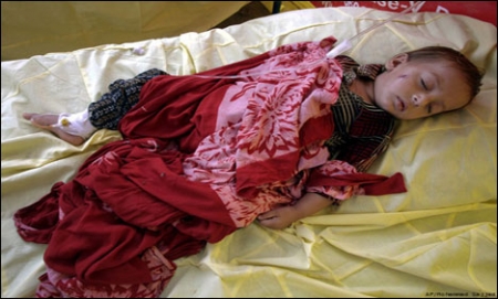 بچے ڈائریا کے مرض میں مبتلا