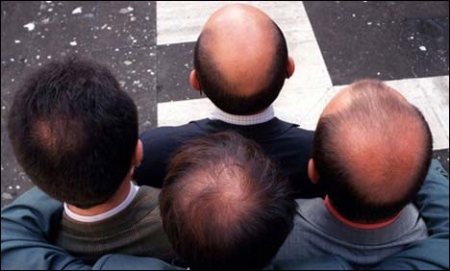 گنج پن کا نیا علاج