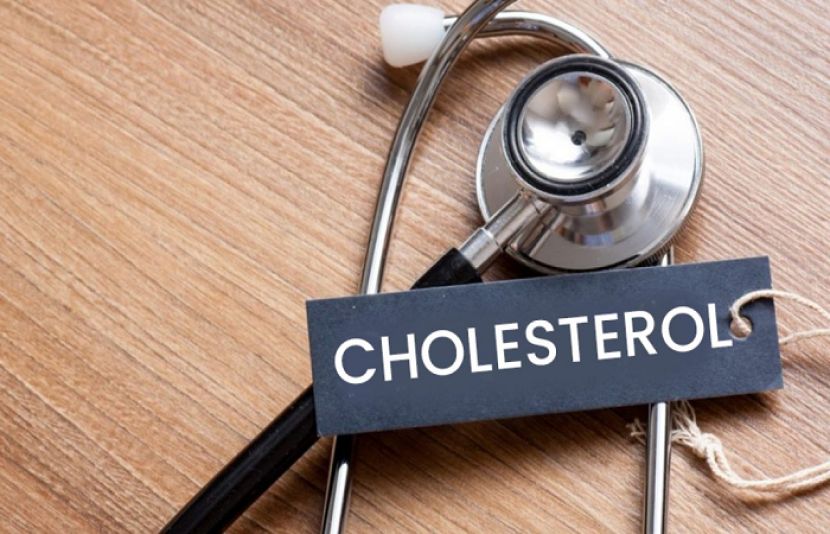 کولیسٹرول