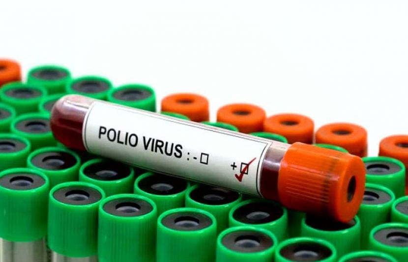 نیشنل ریفرنس لیب نے ملک میں ایک اور پولیو کیس کی تصدیق کر دی ہے
