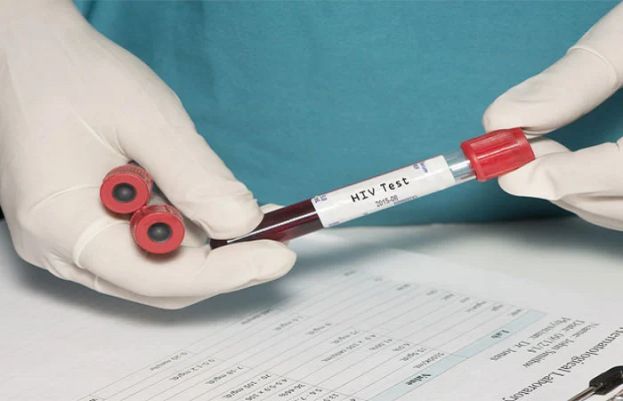 نواب شاہ میں بچوں میں ایچ آئی وی کے مرض میں تشویشناک حد تک اضافہ ہونے کا انکشاف ہوا ہے