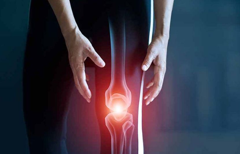 خواتین کے مقابلے میں مرد ہڈیوں کے بھربھرے پن کا زیادہ شکار ہوتے ہیں، ماہرین