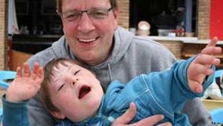 ڈاؤن سنڈروم: احمق نہیں بلکہ مختلف