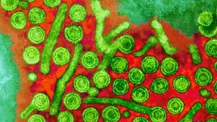 پاکستان کی 10 فیصد آبادی ہیپاٹائٹس کا شکار