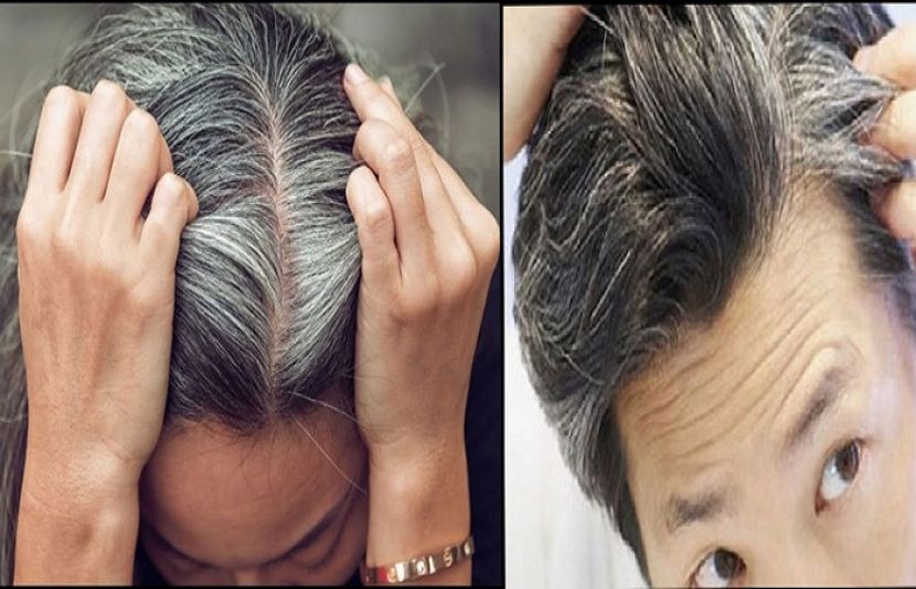 ان نسخوں کو اپنائیں اورسفید بالوں سے نجات پائیں